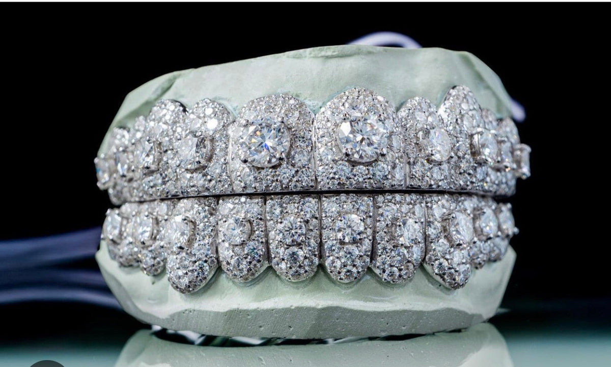 FULLY ICED OUT GRILLZ (Silver and Moissanite)