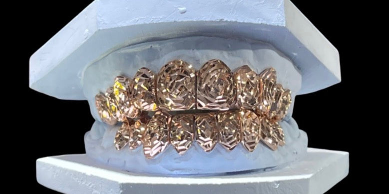 14k Gold Grillz ANY DESIGN