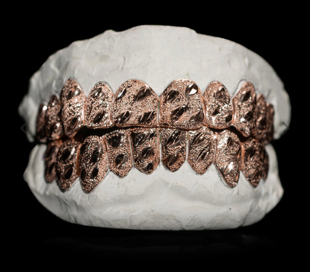 10k Gold Grillz ANY DESIGN
