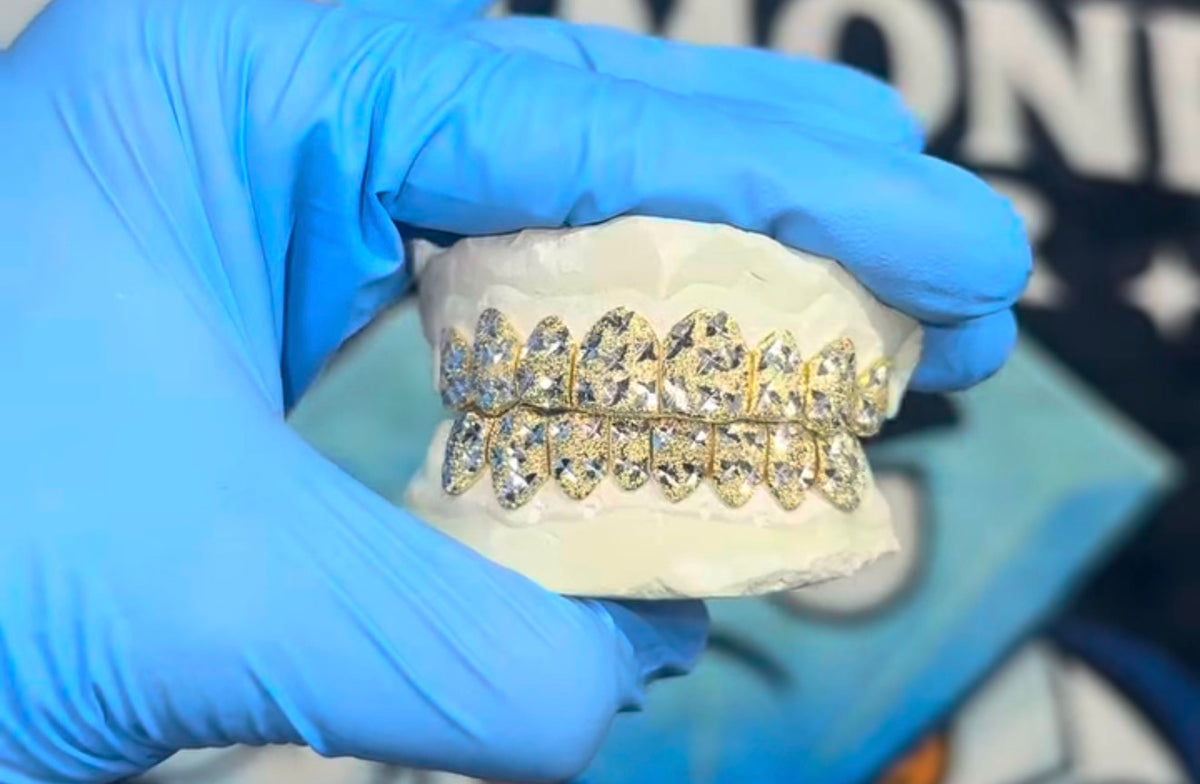 10k Gold Grillz ANY DESIGN
