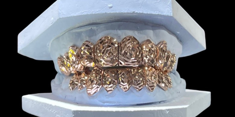 10k Gold Grillz ANY DESIGN